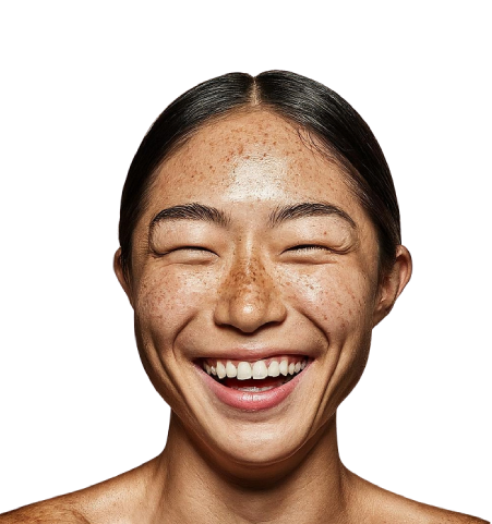 A New Melasma & Pigmentation Treatment in Melbourne